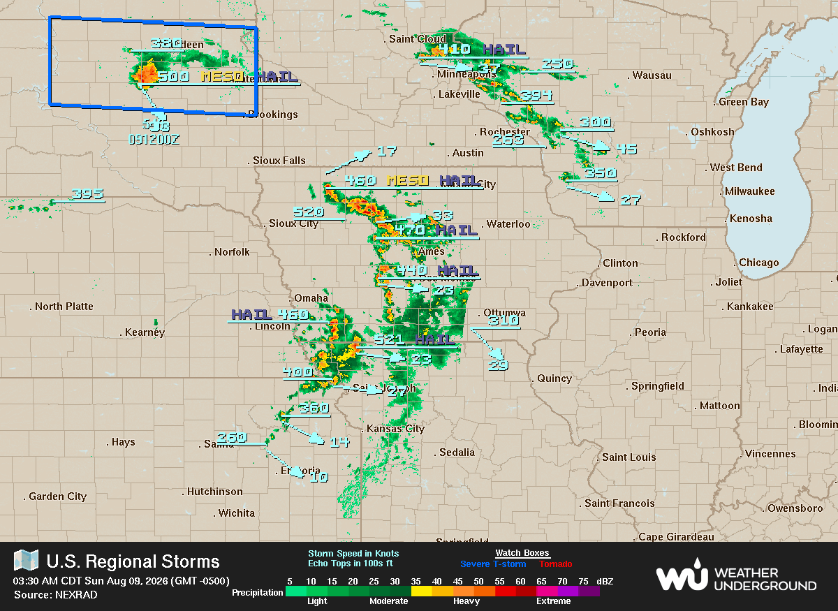 DSM Doppler Sequence